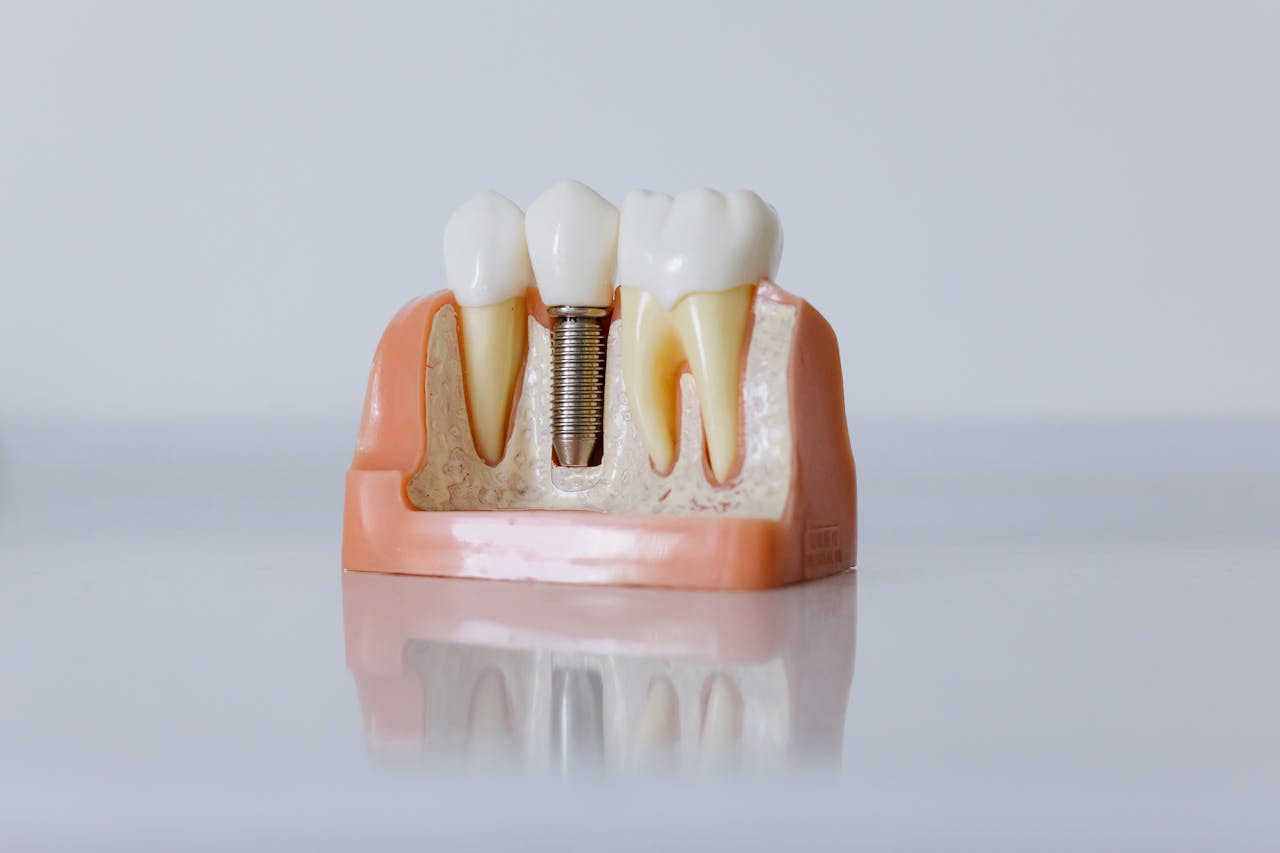 Detailed dental implant model showcasing teeth structure for educational purposes.